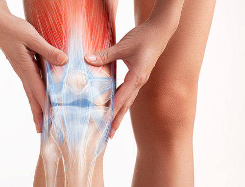 10 Commonly Asked Orthopaedic Questions