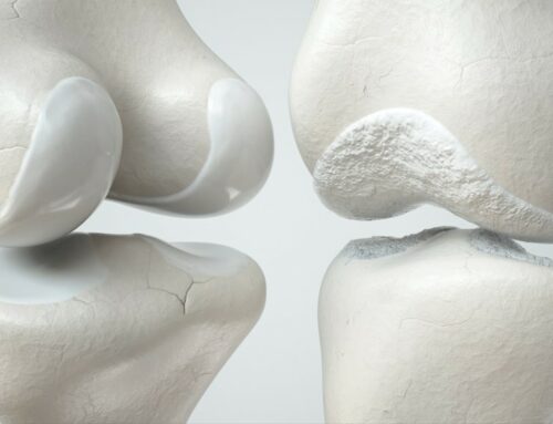Arthritis Awareness Month: Debunking Arthritis Myths
