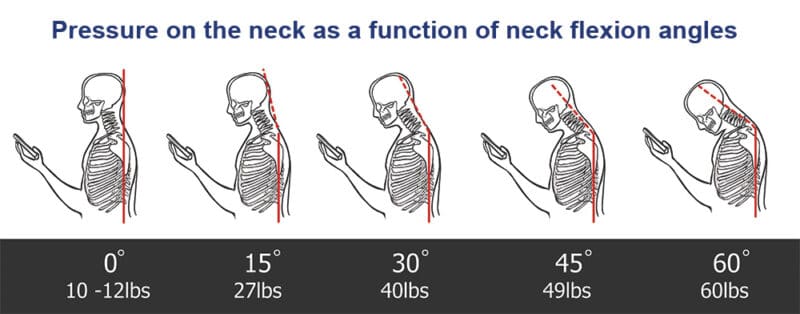 spine-pressure spine-pressure