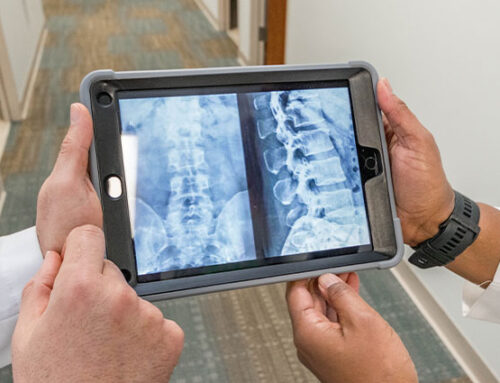 What is a Spinal Fusion?