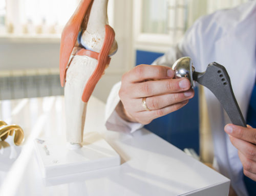 Reasons for Joint Replacement Surgery