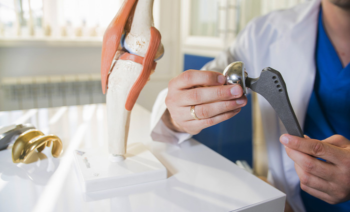 Reasons for Joint Replacement