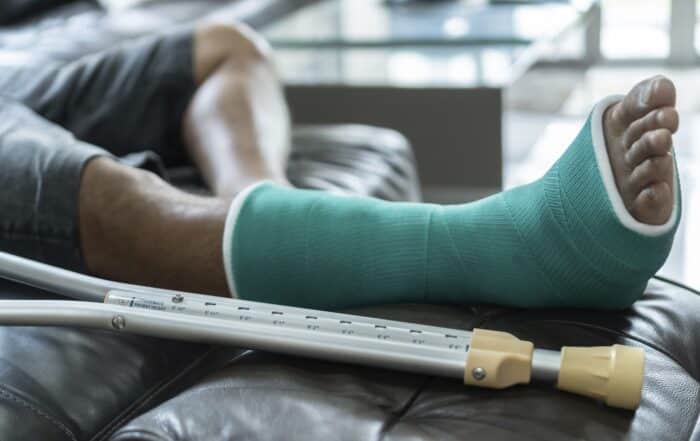 man on sofa with a bone fracture, cast and crutches