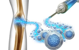 3D illustration of orthopedic stem cell therapy used for regenerative health.